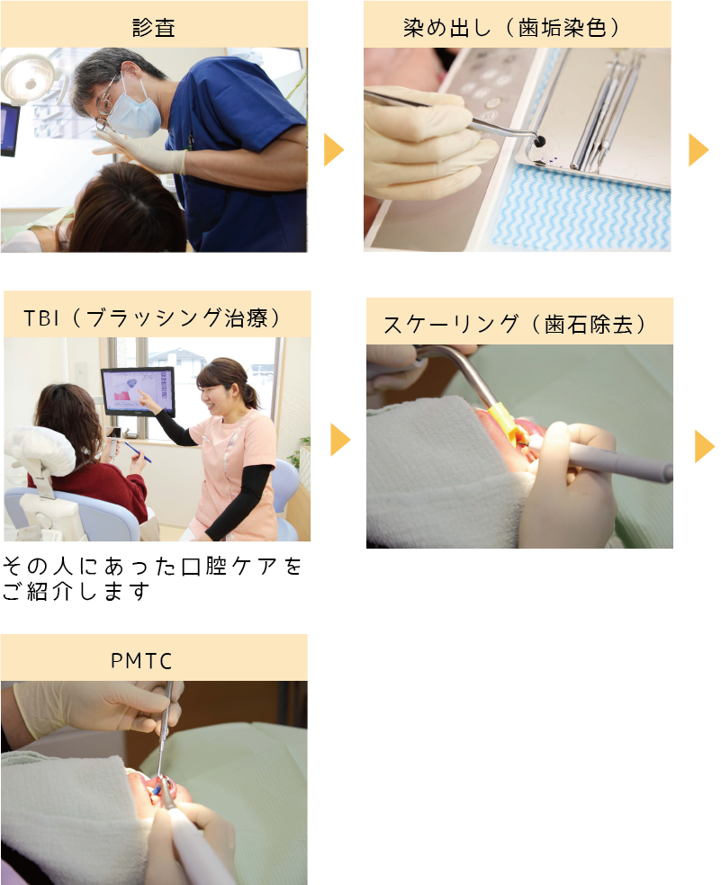 熊本県熊本市中央区の歯科医院-ひかる歯科ちえこども歯科の大人の予防ケアのメンテナンス2