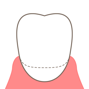 歯頚部
